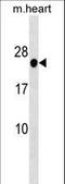 Homeobox B7 antibody, LS-B10563, Lifespan Biosciences, Western Blot image 