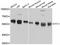 Atlastin GTPase 3 antibody, STJ114088, St John