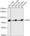 Nexilin antibody, GTX66168, GeneTex, Western Blot image 