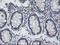 NFKB Inhibitor Interacting Ras Like 1 antibody, M11990, Boster Biological Technology, Immunohistochemistry paraffin image 