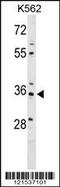 PDZ And LIM Domain 4 antibody, 59-580, ProSci, Western Blot image 