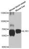 Interleukin 1 Receptor Type 1 antibody, orb178554, Biorbyt, Western Blot image 