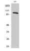 RAB3 GTPase Activating Protein Catalytic Subunit 1 antibody, A04789, Boster Biological Technology, Western Blot image 