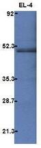 C-Terminal Src Kinase antibody, MA1-34816, Invitrogen Antibodies, Western Blot image 