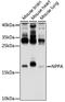 Natriuretic Peptide A antibody, GTX55513, GeneTex, Western Blot image 