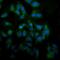 Mitogen-Activated Protein Kinase Kinase Kinase 8 antibody, PB10007, Boster Biological Technology, Immunofluorescence image 