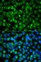 Interleukin 1 Receptor Type 2 antibody, 15-356, ProSci, Immunofluorescence image 