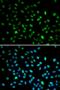 DNA Nucleotidylexotransferase antibody, orb378037, Biorbyt, Immunocytochemistry image 