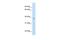 Zinc Finger MYND-Type Containing 11 antibody, PA5-40959, Invitrogen Antibodies, Western Blot image 