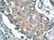 Protein Phosphatase, Mg2+/Mn2+ Dependent 1B antibody, 13193-1-AP, Proteintech Group, Immunohistochemistry frozen image 