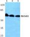 Solute Carrier Family 6 Member 1 antibody, A05109-1, Boster Biological Technology, Western Blot image 