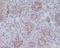 Melanoma Cell Adhesion Molecule antibody, M01683-1, Boster Biological Technology, Immunohistochemistry frozen image 