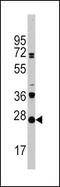 CD3g Molecule antibody, PA5-11579, Invitrogen Antibodies, Western Blot image 