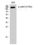 Janus Kinase 3 antibody, A02598Y785, Boster Biological Technology, Western Blot image 