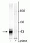 Gap Junction Protein Alpha 1 antibody, P00599, Boster Biological Technology, Western Blot image 