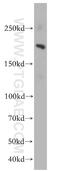 Lysine Demethylase 3B antibody, 19915-1-AP, Proteintech Group, Western Blot image 