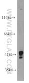 OFD1 Centriole And Centriolar Satellite Protein antibody, 22851-1-AP, Proteintech Group, Western Blot image 