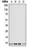 Profilin 2 antibody, orb214386, Biorbyt, Western Blot image 