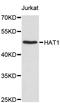 Histone Acetyltransferase 1 antibody, abx126927, Abbexa, Western Blot image 