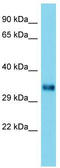 Homer Scaffold Protein 2 antibody, TA343171, Origene, Western Blot image 