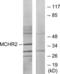 Melanin Concentrating Hormone Receptor 2 antibody, LS-C120740, Lifespan Biosciences, Western Blot image 