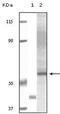 RAC-gamma serine/threonine-protein kinase antibody, MA5-15291, Invitrogen Antibodies, Western Blot image 
