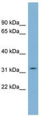 Chromosome 22 Open Reading Frame 31 antibody, TA344505, Origene, Western Blot image 