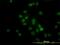 Histone Deacetylase 1 antibody, H00003065-M14, Novus Biologicals, Immunocytochemistry image 