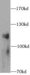 Lysosomal Associated Membrane Protein 1 antibody, FNab04684, FineTest, Western Blot image 