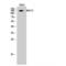 ABL Proto-Oncogene 1, Non-Receptor Tyrosine Kinase antibody, LS-C381862, Lifespan Biosciences, Western Blot image 