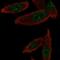 Gem Nuclear Organelle Associated Protein 6 antibody, NBP2-58682, Novus Biologicals, Immunofluorescence image 