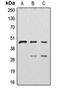 Cathepsin D antibody, LS-B14253, Lifespan Biosciences, Western Blot image 