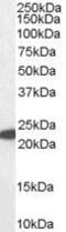 Glutathione Peroxidase 1 antibody, PA5-18532, Invitrogen Antibodies, Western Blot image 