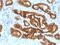 Alpha-Methylacyl-CoA Racemase antibody, GTX02587, GeneTex, Immunohistochemistry paraffin image 