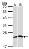 C-Reactive Protein antibody, GTX101262, GeneTex, Western Blot image 