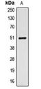 Aldehyde Dehydrogenase 3 Family Member A1 antibody, orb213548, Biorbyt, Western Blot image 