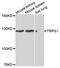 Transcriptional Repressor GATA Binding 1 antibody, PA5-76254, Invitrogen Antibodies, Western Blot image 