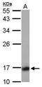 Protein Phosphatase 3 Regulatory Subunit B, Alpha antibody, GTX114181, GeneTex, Western Blot image 