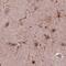 Sorcin antibody, NBP2-57990, Novus Biologicals, Immunohistochemistry paraffin image 
