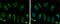 Heat Shock Protein Family A (Hsp70) Member 5 antibody, GTX127934, GeneTex, Immunocytochemistry image 