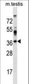 Surfeit 4 antibody, LS-C157113, Lifespan Biosciences, Western Blot image 