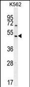 Regulator Of G Protein Signaling 7 antibody, PA5-48324, Invitrogen Antibodies, Western Blot image 