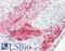 Tenascin C antibody, LS-B8789, Lifespan Biosciences, Immunohistochemistry frozen image 