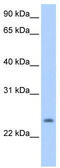 Solute Carrier Family 66 Member 2 antibody, TA338695, Origene, Western Blot image 