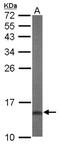 Dual Specificity Phosphatase 23 antibody, NBP2-16240, Novus Biologicals, Western Blot image 