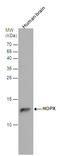 HOP Homeobox antibody, GTX131224, GeneTex, Western Blot image 