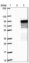 TBC1 Domain Family Member 14 antibody, NBP1-82913, Novus Biologicals, Western Blot image 