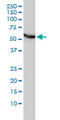 Chaperonin Containing TCP1 Subunit 5 antibody, LS-B5451, Lifespan Biosciences, Western Blot image 