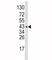 Wnt Family Member 5B antibody, F51230-0.4ML, NSJ Bioreagents, Western Blot image 