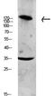 Collagen Type XI Alpha 1 Chain antibody, A02909-2, Boster Biological Technology, Western Blot image 